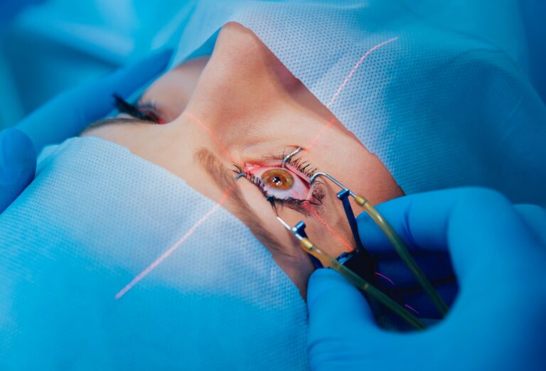 Laser vision correction. A patient and team of surgeons in the operating room during ophthalmic surgery. Eyelid speculum. Lasik treatment. Patient under sterile cover